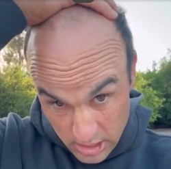 太陽報：前美國國腳多諾萬為脫發(fā)苦惱，向粉絲求助幫忙挑假發(fā)